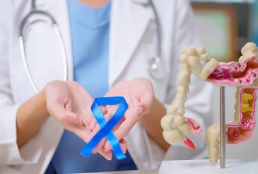 یک میلیون نفر از کیت نانویی برای غربالگری سرطان روده استفاده کرده‌اند