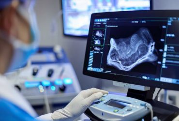 تولید میکروحباب‌های لیپیدی برای ارتقای دقت تصویربرداری سونوگرافی