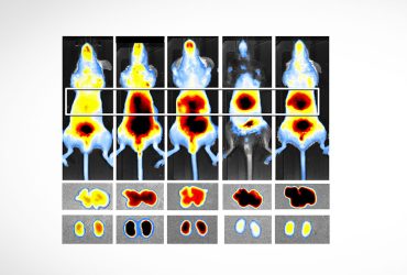 فلوویژن، چشم دیجیتال ساخت ایران برای رصد سرطان