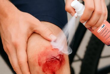 محلول نانویی ضدعفونی‌کننده؛ تسریع بهبود زخم و کاهش عفونت