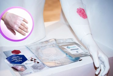پانسمان زخم‌های مزمن سوختگی و دیابت با زخم‌پوش نانوی ایرانی