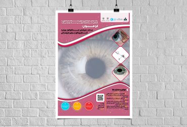 دعوت به همکاری در ساخت و تولید داروهای ضد گلوکوم ایرانی