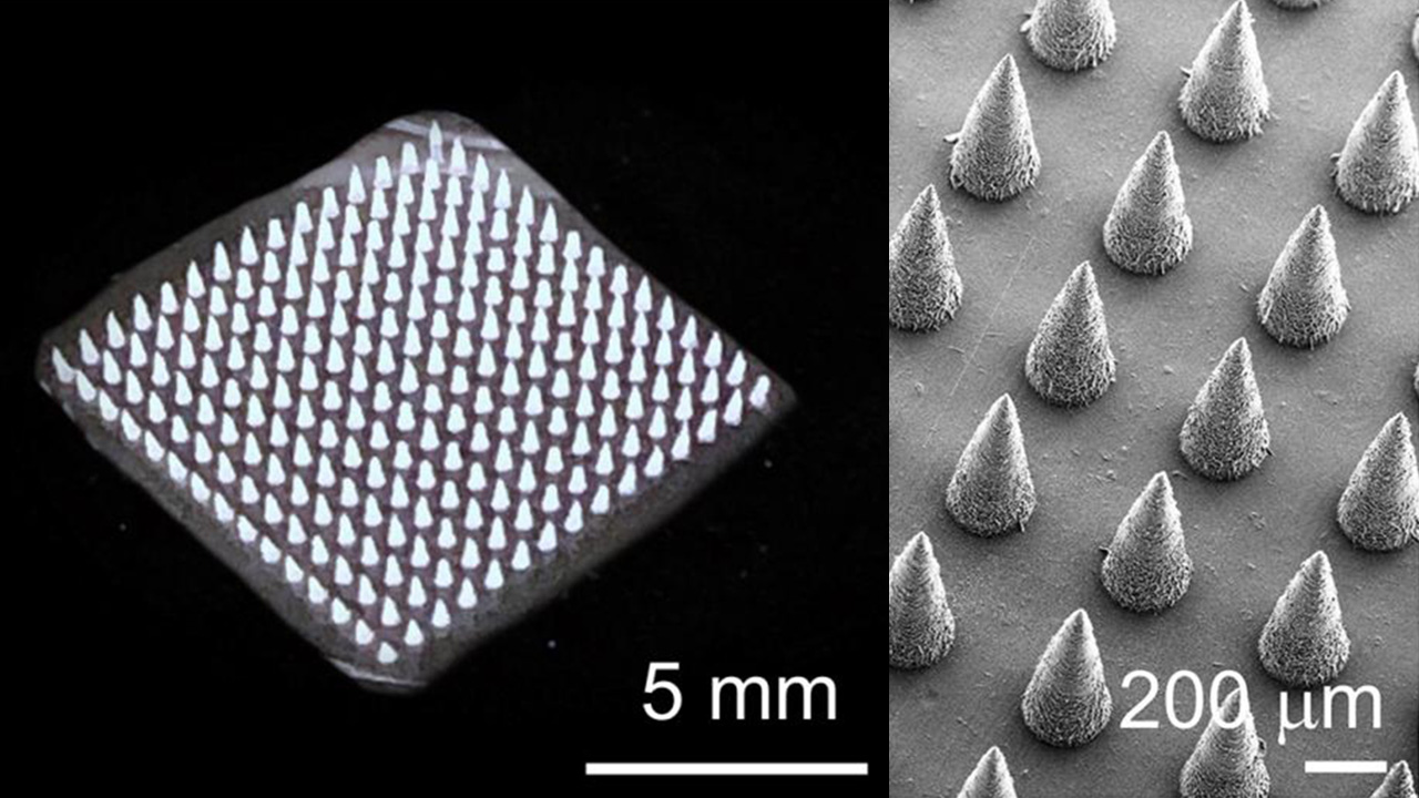 استارت‌آپ نانویی برای درمان‌های پوستی میکرونیدل تجزیه‌پذیر می‌سازد